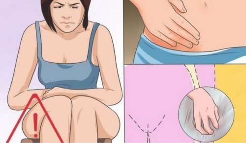 As causas, sintomas e tratamento da candidíase vaginal