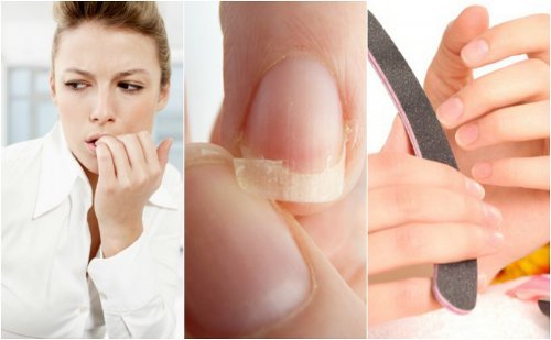 8 razões das unhas frágeis