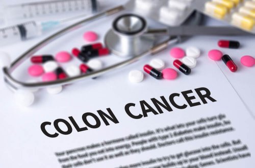 Tratamento medicamentoso do câncer de cólon