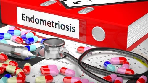 Tratamento farmacológico da endometriose