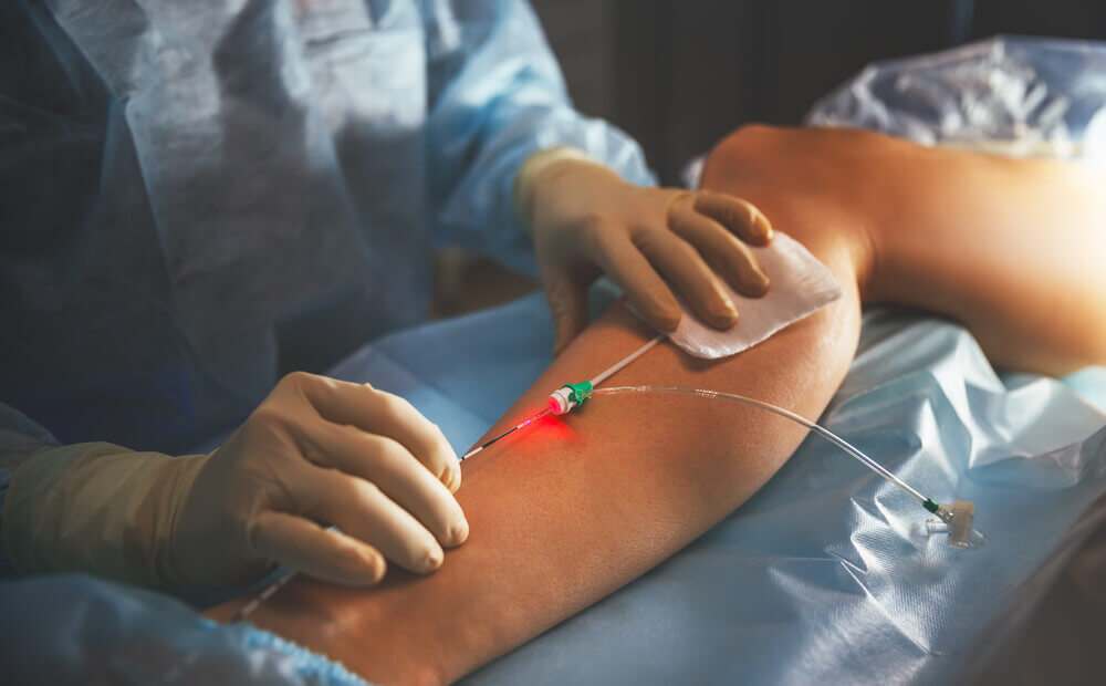 Tratamento médico para as varizes