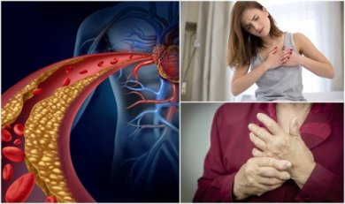 Você tem colesterol alto? Descubra através desses 10 sintomas