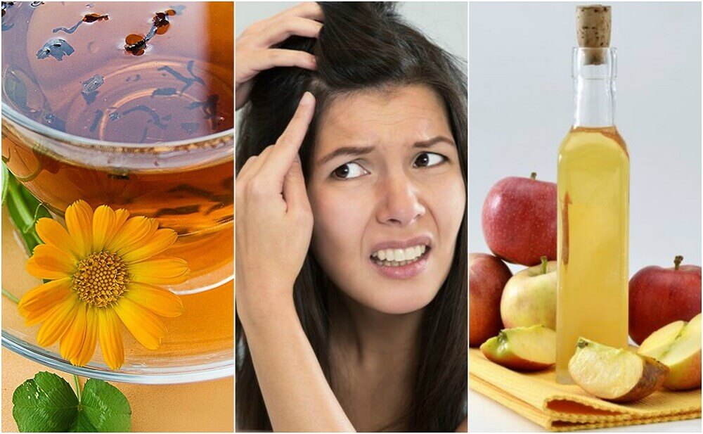 5 remédios de origem natural para aliviar o couro cabeludo sensível 5 remédios de origem natural para aliviar o couro cabeludo sensível