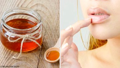 6 remédios naturais para as rachaduras nos lábios