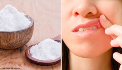 8 remédios para curar feridas bucais