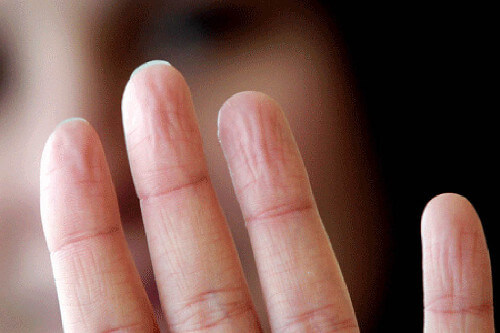 Mãos enrugadas revelam problemas de saúde