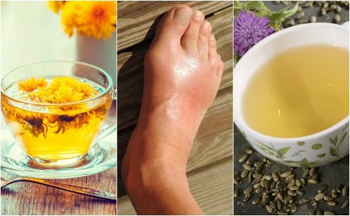 As 5 melhores infusões para diminuir os níveis de ácido úrico