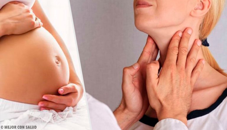 Como reduzir o desconforto do hipotireoidismo durante a gravidez?