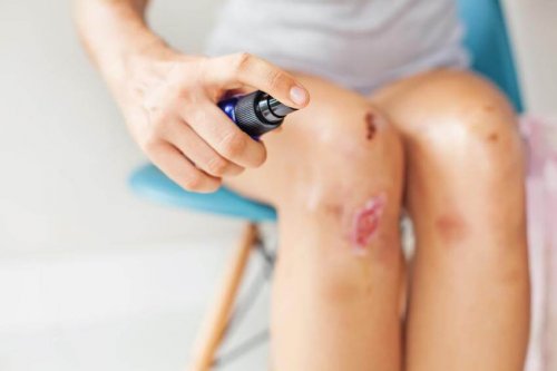 Água oxigenada serve para desinfetar feridas