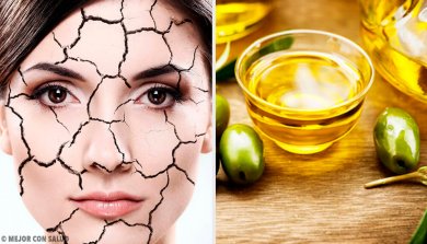 Maneiras naturais de reduzir ressecamento da pele
