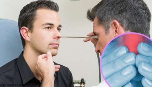 Médico examinando nariz do paciente