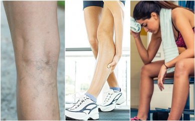6 coisas que podem causar câimbras