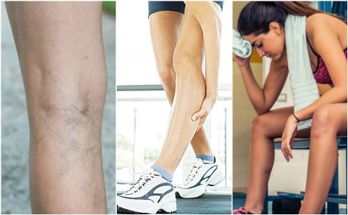 6 coisas que podem causar câimbras