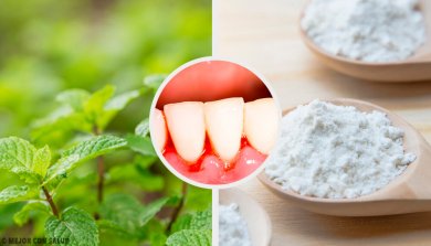 5 remédios caseiros para a gengivite