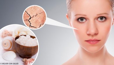 5 remédios naturais para combater o ressecamento da pele