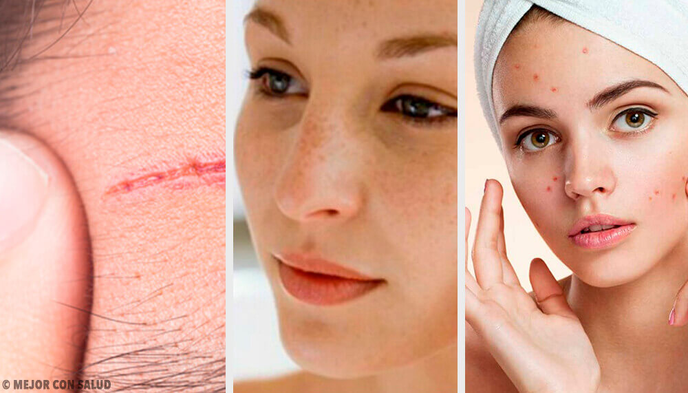 Os problemas mais comuns no rosto e como tratá-los