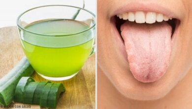 7 remédios naturais para a língua branca
