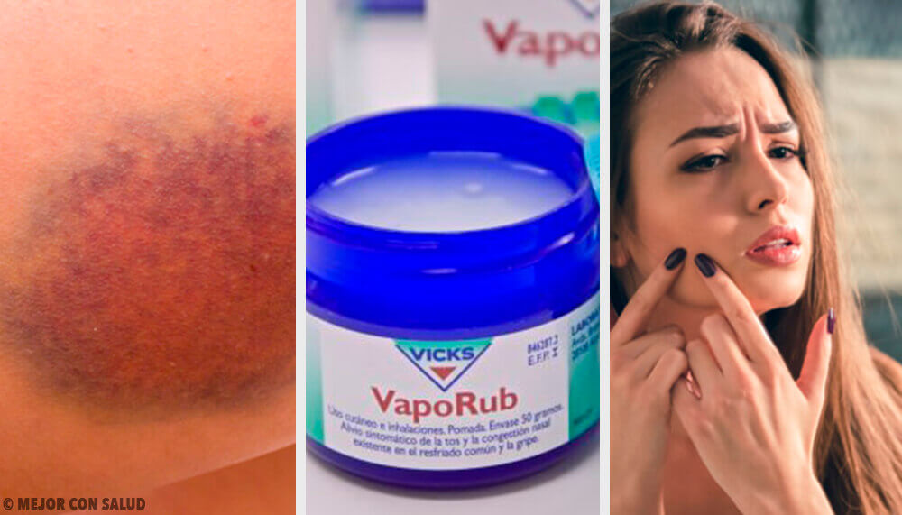 11 usos desconhecidos do Vick Vaporub 11 usos desconhecidos do Vick Vaporub