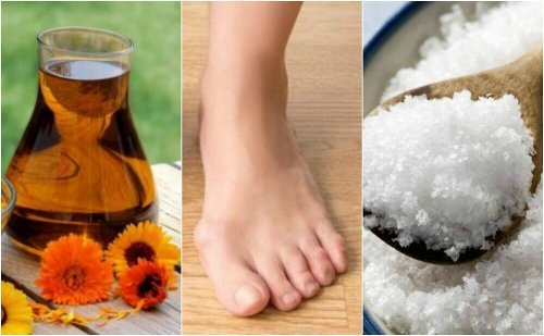 4 soluções naturais para reduzir os joanetes