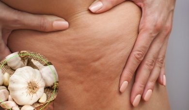 5 alternativas para combater a celulite