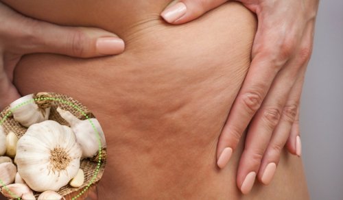 5 alternativas para combater a celulite
