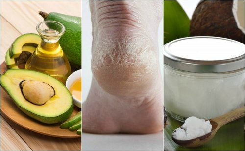 5 cremes caseiros para hidratar calcanhares ressecados