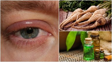5 remédios caseiros para a inflamação das pálpebras