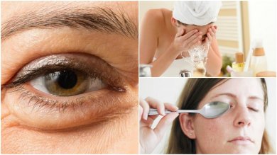 6 métodos naturais para reduzir as bolsas debaixo dos olhos