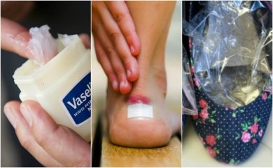 7 soluções para impedir que os sapatos façam calos nos pés
