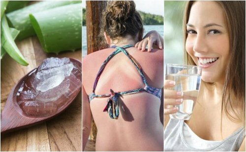 9 medidas de emergência para tratar as queimaduras de sol