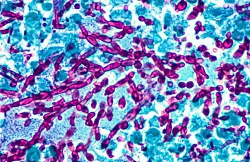 Bactérias das infecções vaginais