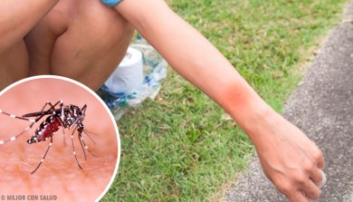 O que acontece quando você coça uma picada de mosquito?