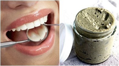 Como tratar e prevenir as cáries com um remédio natural