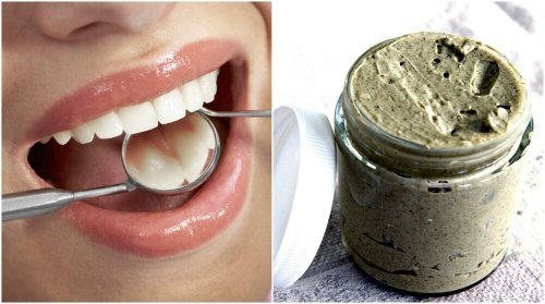 Como tratar e prevenir as cáries com um remédio natural