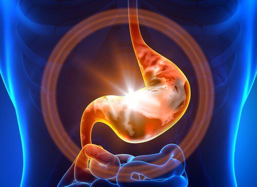 Imagen da gastroenterite