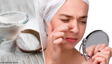4 máscaras com bicarbonato de sódio para remover cravos