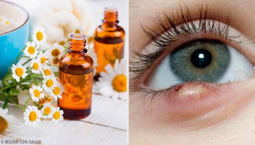 5 truques para eliminar um terçol com facilidade