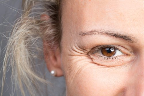 Rugas faciais nos olhos