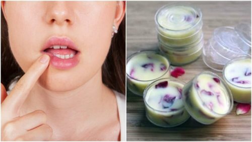 Como fazer um protetor labial caseiro