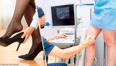 3 remédios naturais para eliminar as varizes rapidamente