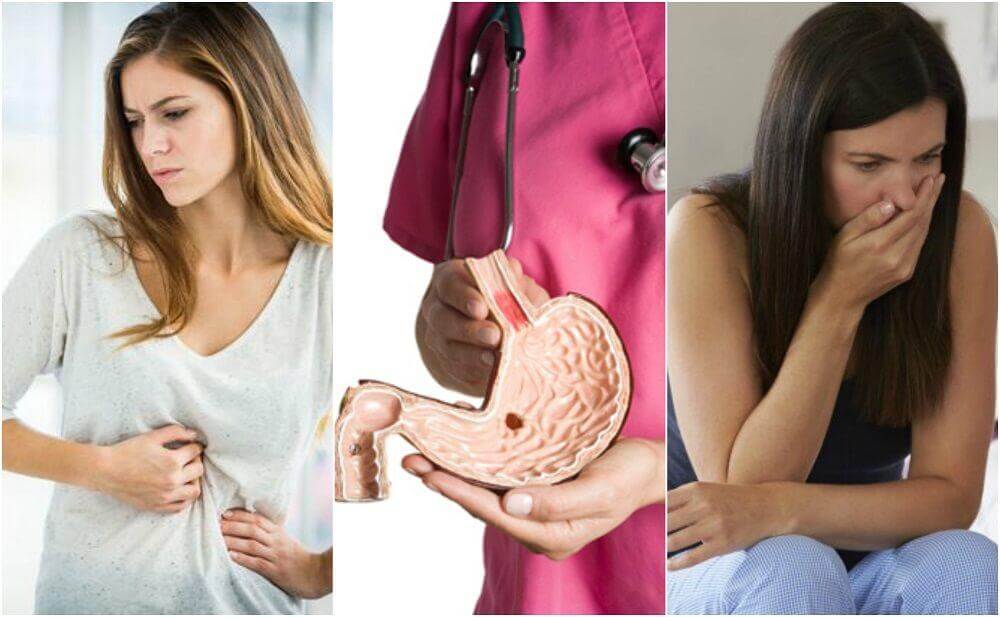 10 sintomas que o alertam para uma úlcera péptica 10 sintomas que o alertam para uma úlcera péptica