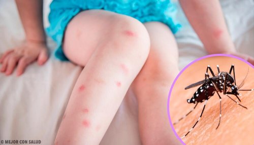 5 picadas de insetos mais comuns e como tratá-las