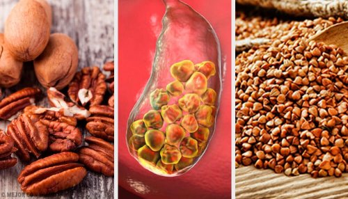 6 alimentos para combater as pedras biliares