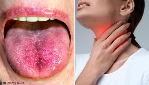 6 formas de saber se há placas na garganta