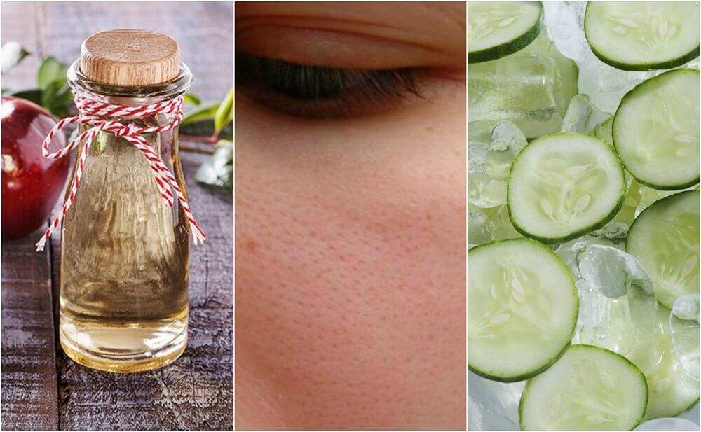 6 Recursos Naturais que você pode usar para fechar os poros abertos 6 Recursos Naturais que você pode usar para fechar os poros abertos