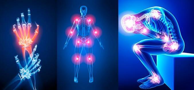 Articulações: sua importância e alguns suplementos Articulações: sua importância e alguns suplementos