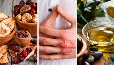 Eczema da pele: causas, sintomas, diagnóstico e tratamento natural