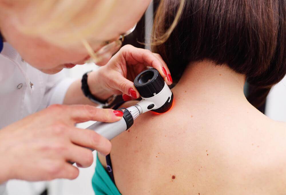 O melanoma é o único tipo grave de câncer de pele?