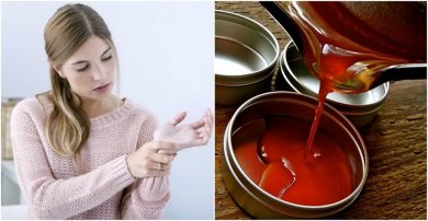 Pomadas anti-inflamatórios de pimenta caiena para aliviar a dor nas articulações