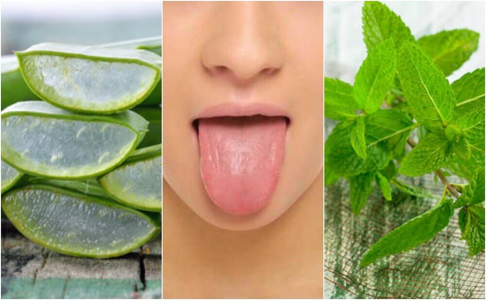 6 tratamentos de origem natural para aliviar as aftas na língua